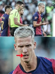 Dani Olmo lost a tooth after a tackle from Marc Bartra during the match against Real Betis, but amazingly, he later found it on the pitch