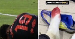 Lamine Yamal shows BRUTAL aftermath of a Las Palmas defender stepping on his foot